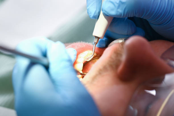 Best After-Hours Emergency Dentist in Jefferson, IA