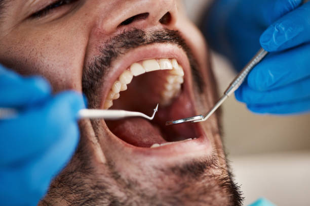 Best Walk-In Emergency Dentist in Jefferson, IA